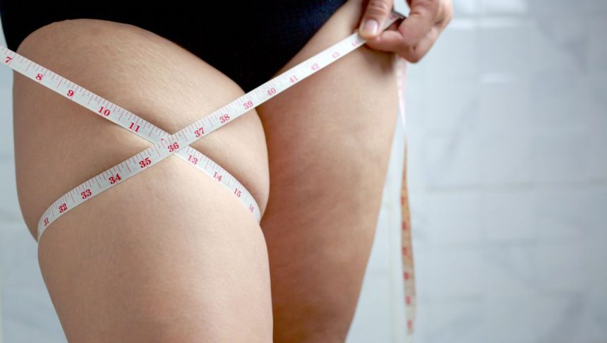 A woman is measuring her thigh, which has saddlebags.